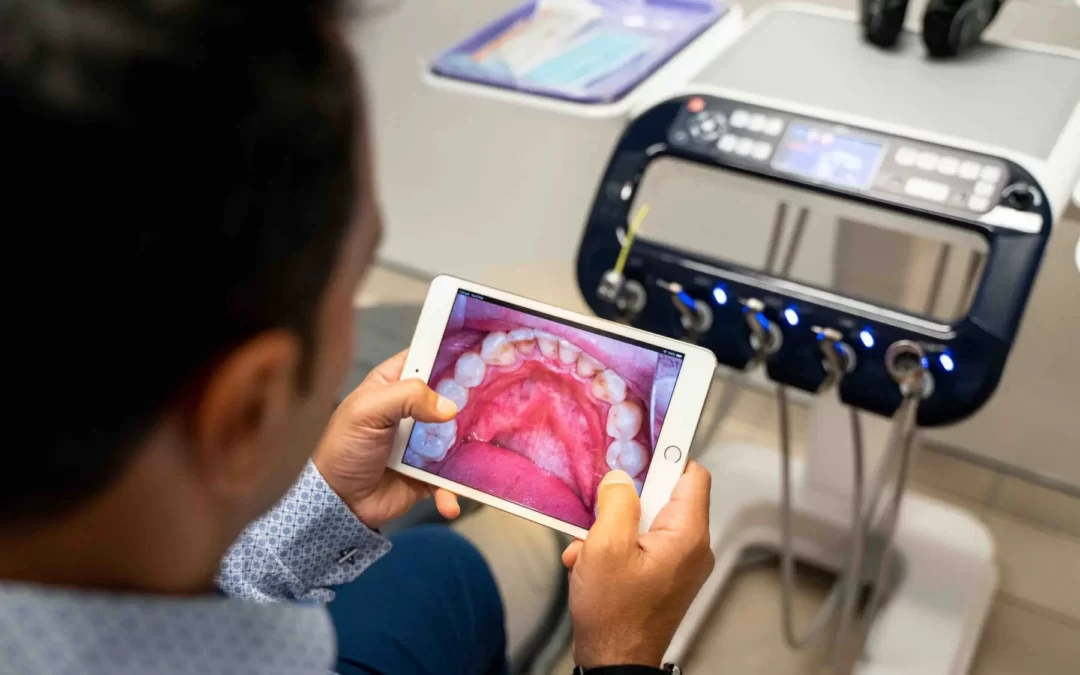 Full Mouth rehabilitation with implant