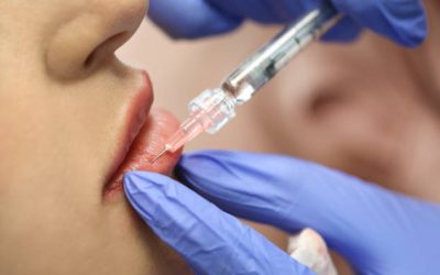 What Is a Dermal Filler and How Can It Improve Your Look