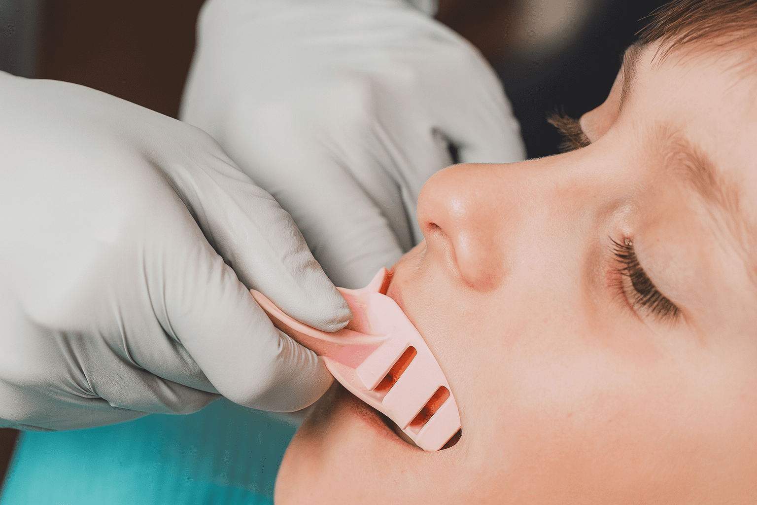 kid getting myobraces in a dental clinic in narellan