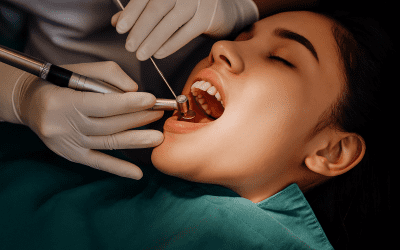 Is Root Canal Treatment Painful? Procedure, Recovery & Expert Tips