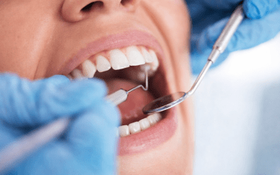 How to Improve Oral Hygiene: Expert Tips and Simple Daily Habits