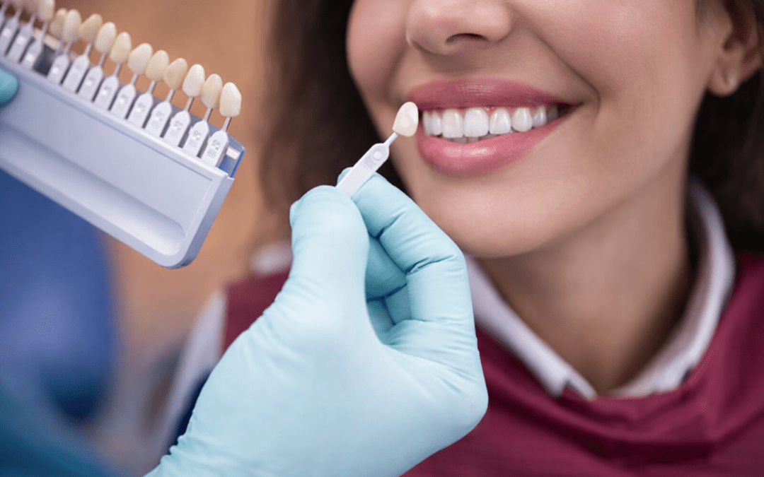 What Are Porcelain Veneers? Procedure, Benefits and Results