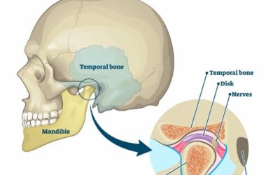 Blog 3 Temporomandibular Disorder (TMD): Symptoms and Causes