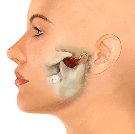 TMJ-Jaw-Locking-1 TMJ-Jaw-Locking
